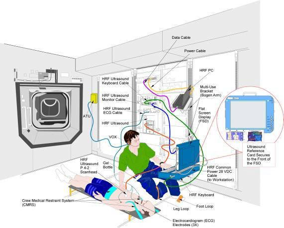 icv_setup A computer-generated diagram of the Integrated Cardiovascular investigation onboard the ISS. Image courtesy of the Johnson Space Center, Human Research Program.