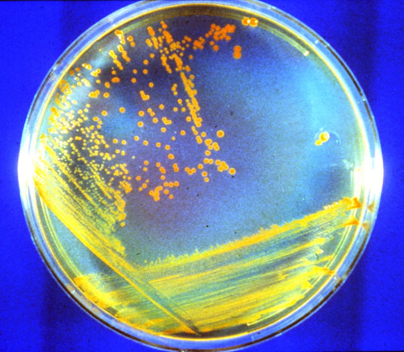 drad_daly D. rad Bacteria: Credit: Michael Daly (Uniformed Services University of the Health Sciences), DOE