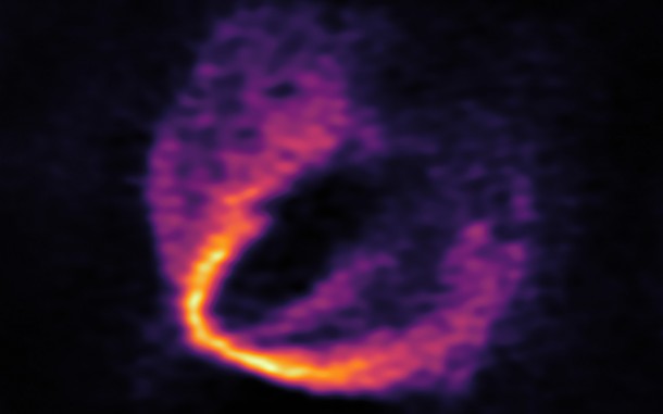 This image shows part of the ALMA data set at one wavelength and reveals a clear “kink” in the material, which indicates unambiguously the presence of one of the planets. Credit: ESO, ALMA (ESO/NAOJ/NRAO); Pinte et al. This image shows part of the ALMA data set at one wavelength and reveals a clear “kink” in the material, which indicates unambiguously the presence of one of the planets. Credit: ESO, ALMA (ESO/NAOJ/NRAO); Pinte et al.
